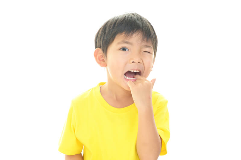 お子さんのむし歯治療について